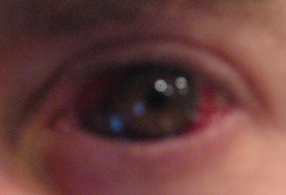 Bokor's eye